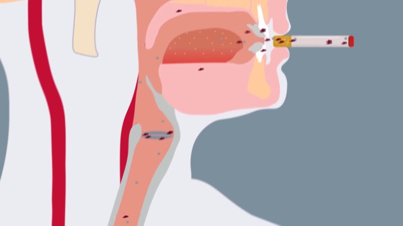 Immediate Sensation in the Throat Post-Smoking